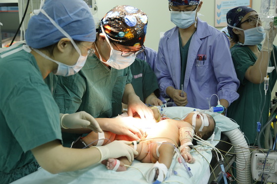 产前精准管理国家儿童医学中心成功分离肝脏联体婴儿